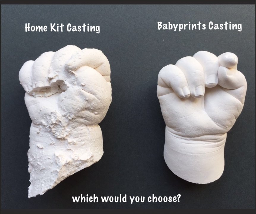Casting kits for hands and feet